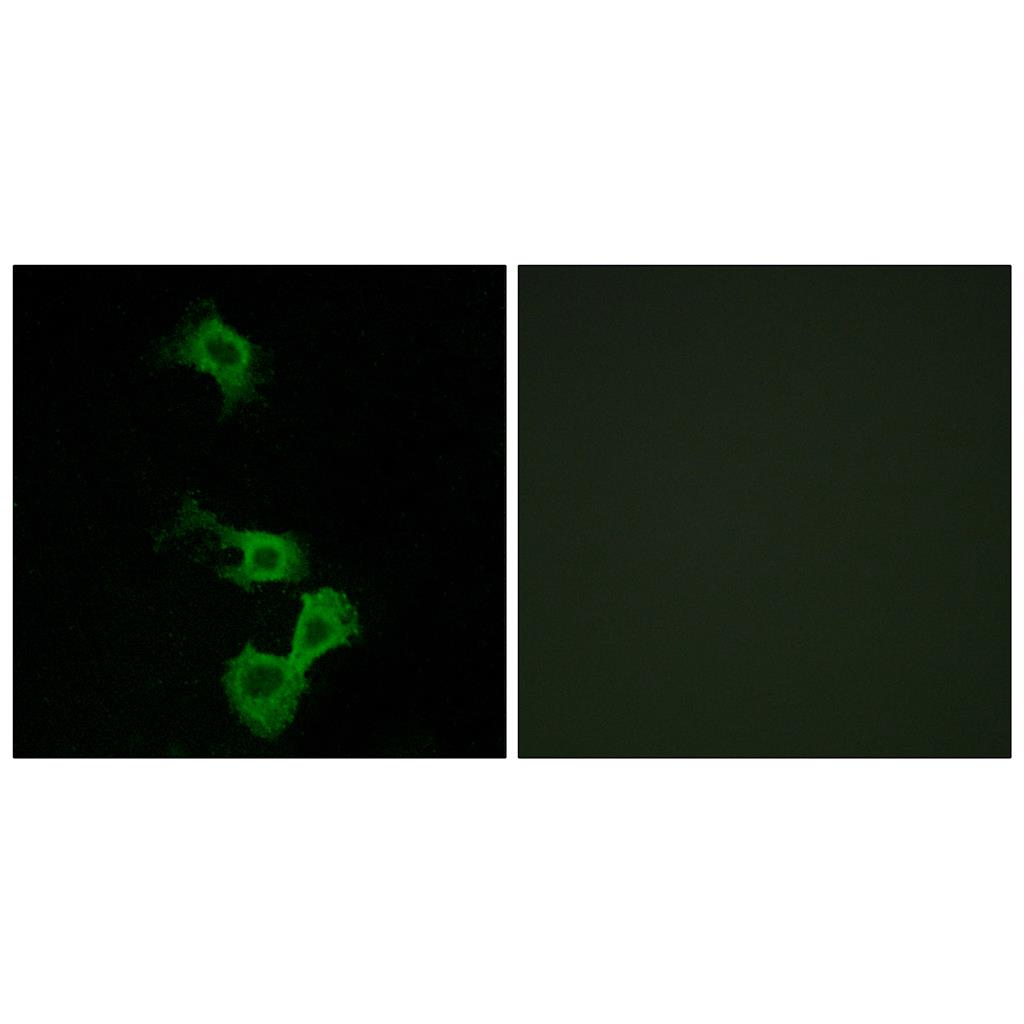 Dab1 Rabbit Polyclonal Antibody | 兔多抗 | EnkiLife恩玑生命