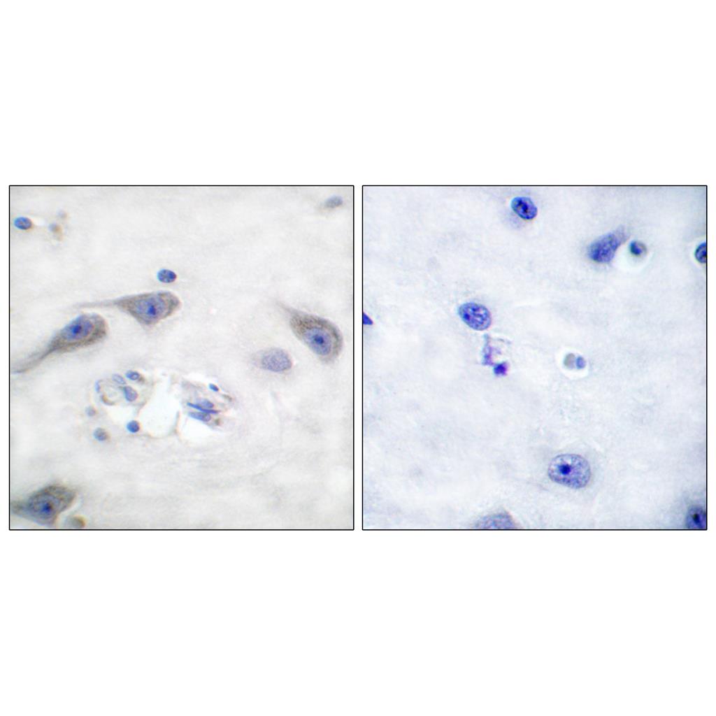 DARPP-32 Rabbit Polyclonal Antibody | 兔多抗 | EnkiLife恩玑生命