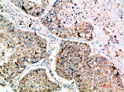 DC-LAMP Rabbit Polyclonal Antibody | 兔多抗 | EnkiLife恩玑生命