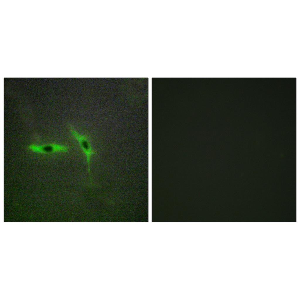 DcR3 Rabbit Polyclonal Antibody | 兔多抗 | EnkiLife恩玑生命