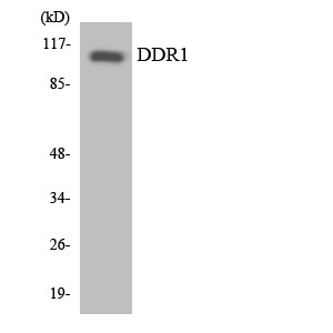 DDR1 Rabbit Polyclonal Antibody | 兔多抗 | EnkiLife恩玑生命