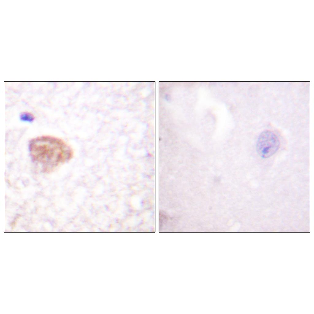 DDX3 Rabbit Polyclonal Antibody | 兔多抗 | EnkiLife恩玑生命