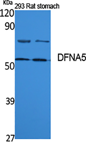 DFNA5 Rabbit Polyclonal Antibody | 兔多抗 | EnkiLife恩玑生命