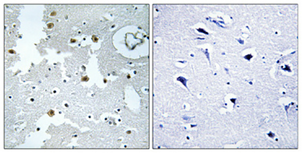 DJ-1 Rabbit Polyclonal Antibody | 兔多抗 | EnkiLife恩玑生命