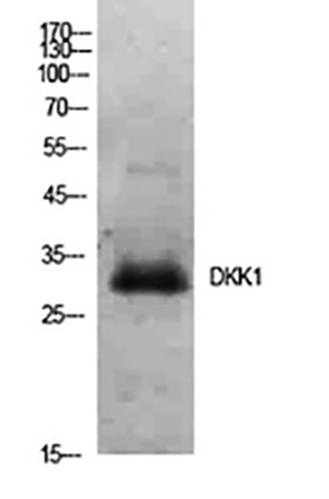 Dkk-1 Rabbit Polyclonal Antibody | 兔多抗 | EnkiLife恩玑生命