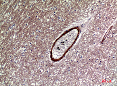 Dkk-1 Rabbit Polyclonal Antibody | 兔多抗 | EnkiLife恩玑生命