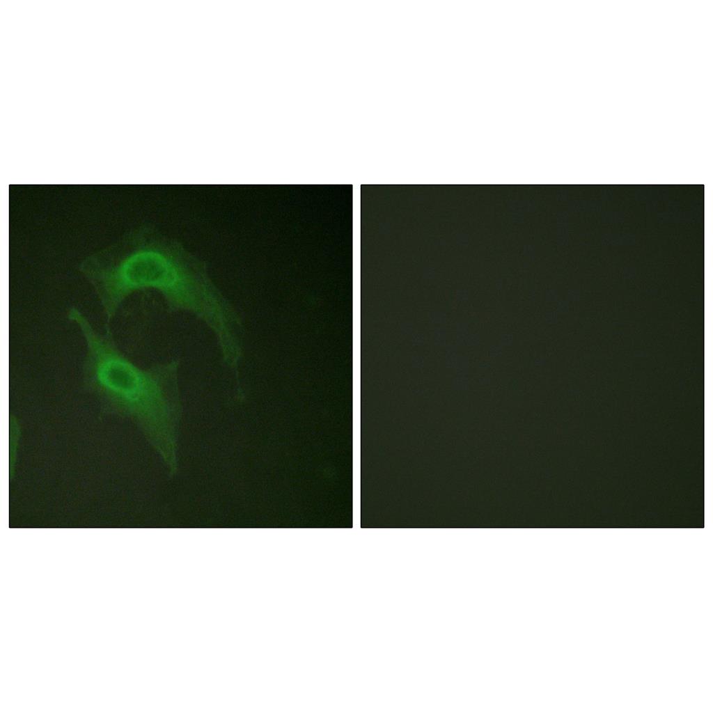 DNAM-1 Rabbit Polyclonal Antibody | 兔多抗 | EnkiLife恩玑生命