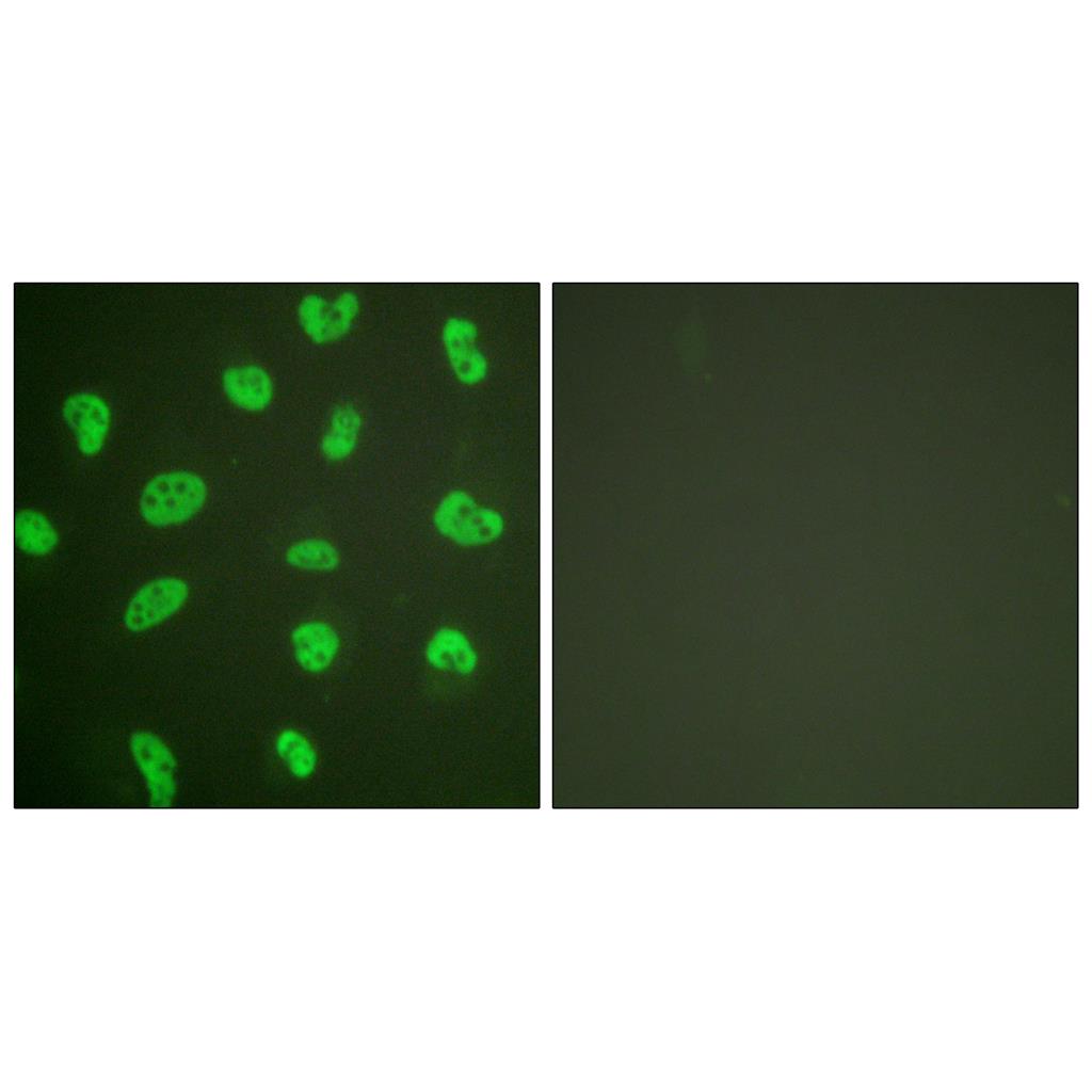 DNA-PKCS Rabbit Polyclonal Antibody | 兔多抗 | EnkiLife恩玑生命