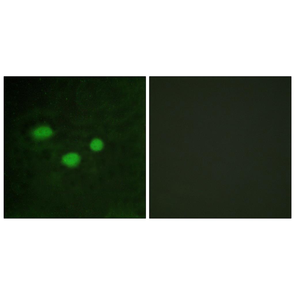 Dnmt3b Rabbit Polyclonal Antibody | 兔多抗 | EnkiLife恩玑生命