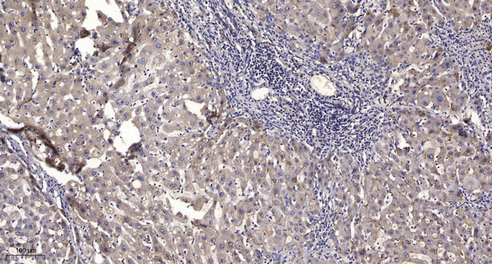 DOCK 2 Rabbit Polyclonal Antibody | 兔多抗 | EnkiLife恩玑生命