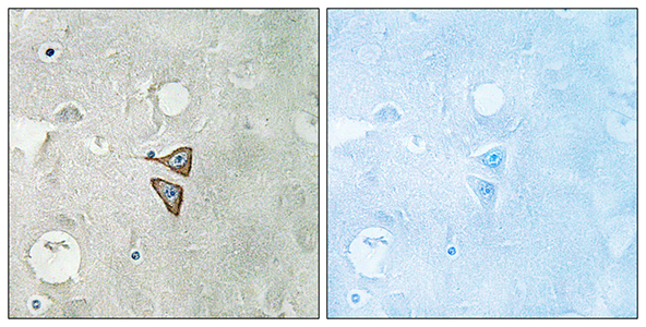 DOR-1 Rabbit Polyclonal Antibody | 兔多抗 | EnkiLife恩玑生命