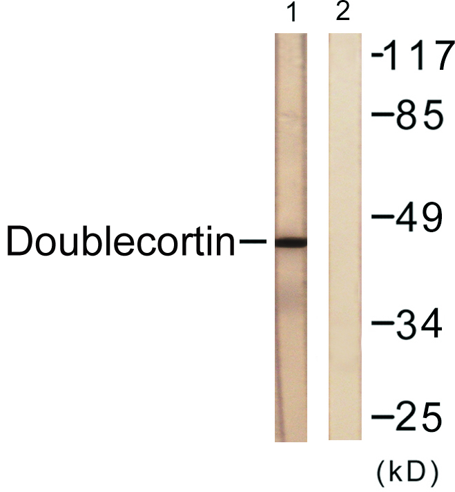 Doublecortin Rabbit Polyclonal Antibody | 兔多抗 | EnkiLife恩玑生命