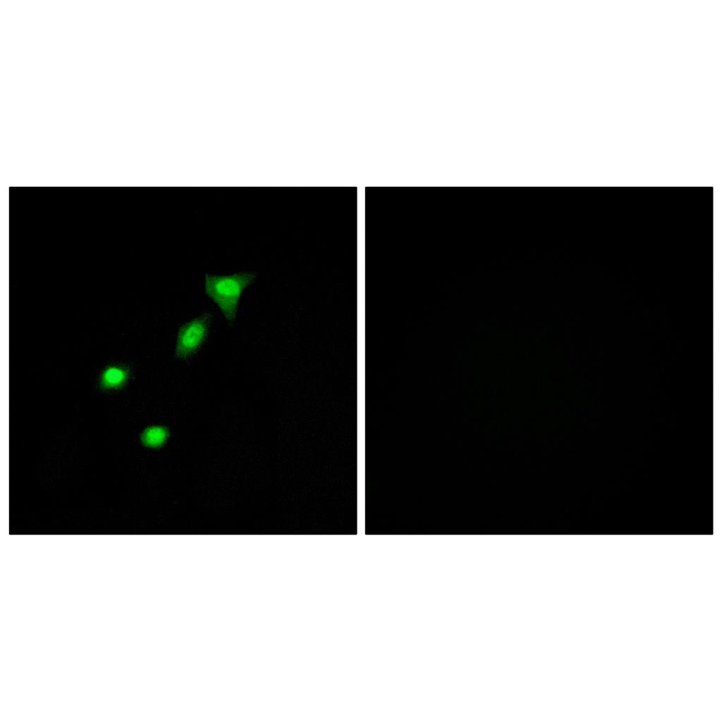 DPF2 Rabbit Polyclonal Antibody | 兔多抗 | EnkiLife恩玑生命