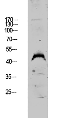 DUSP4 Rabbit Polyclonal Antibody | 兔多抗 | EnkiLife恩玑生命