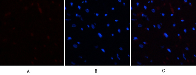 E2F-1 Rabbit Polyclonal Antibody | 兔多抗 | EnkiLife恩玑生命