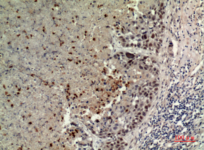 ECA39 Rabbit Polyclonal Antibody | 兔多抗 | EnkiLife恩玑生命