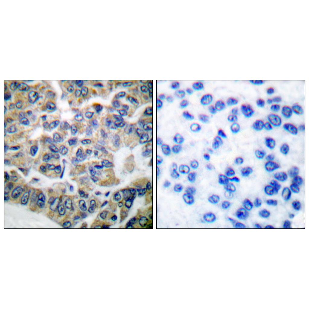eEF2K Rabbit Polyclonal Antibody | 兔多抗 | EnkiLife恩玑生命