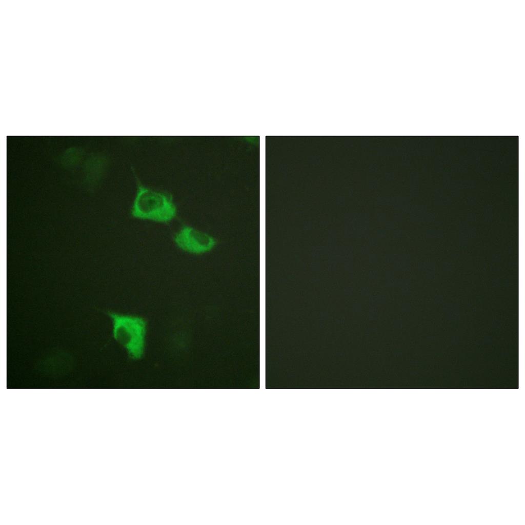 EF-2 Rabbit Polyclonal Antibody | 兔多抗 | EnkiLife恩玑生命