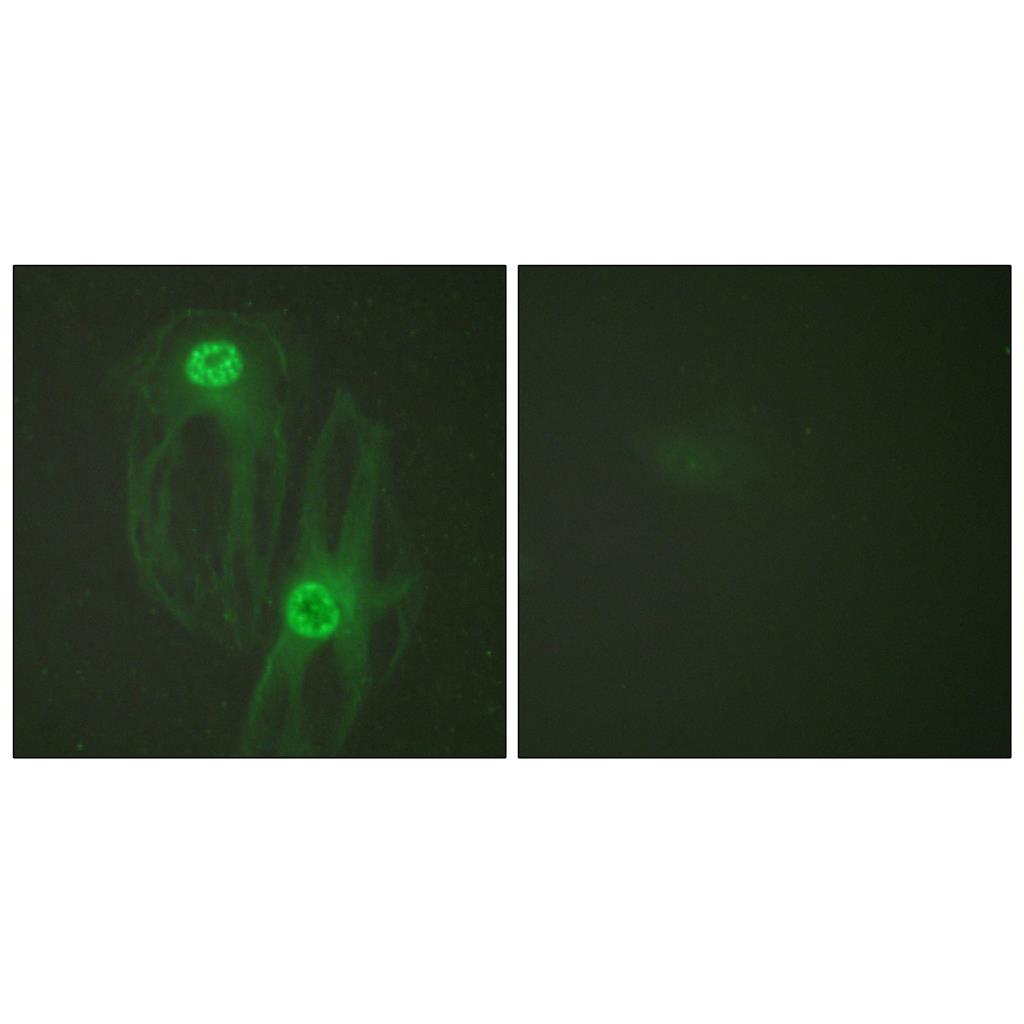 Eg5 Rabbit Polyclonal Antibody | 兔多抗 | EnkiLife恩玑生命