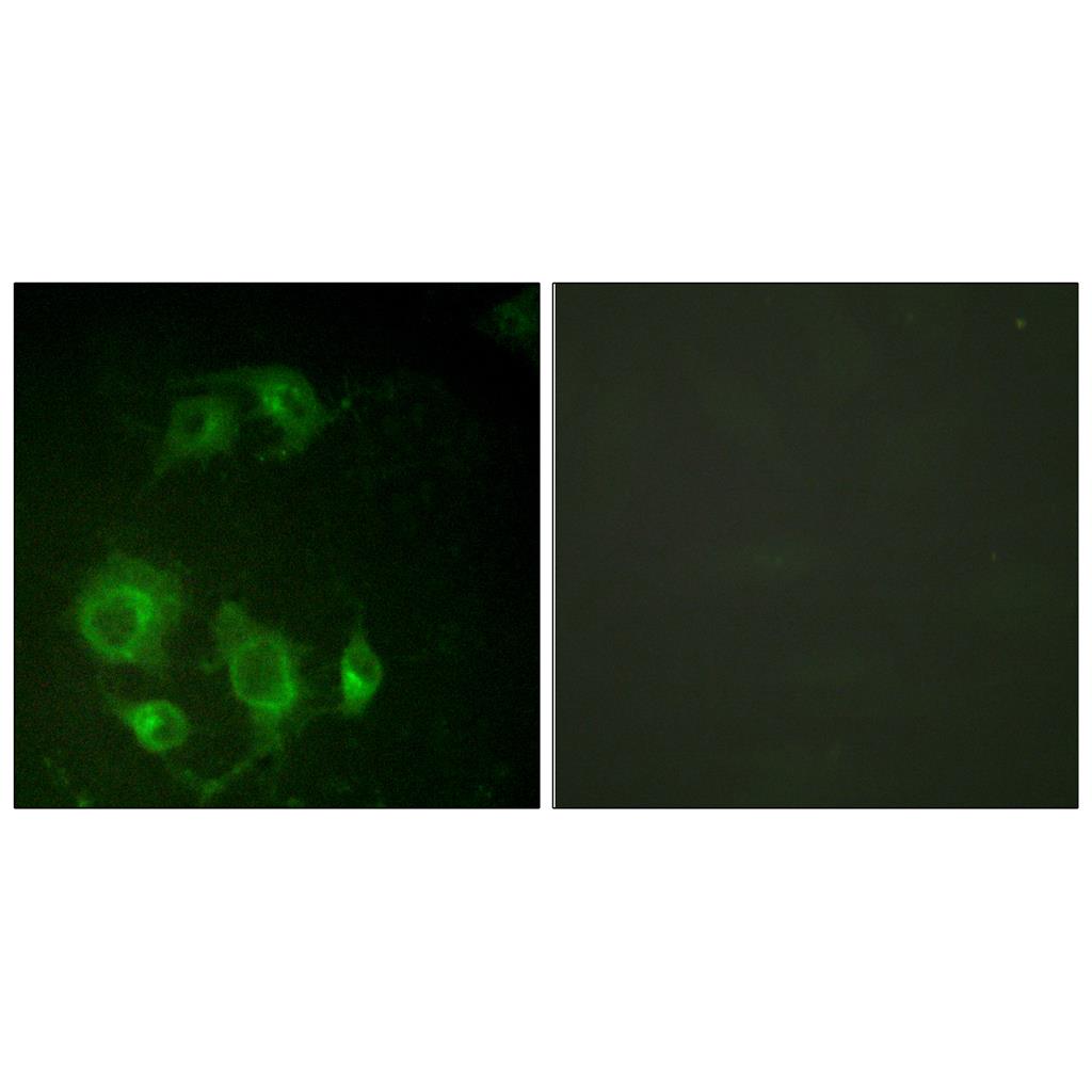 EGFR Rabbit Polyclonal Antibody | 兔多抗 | EnkiLife恩玑生命