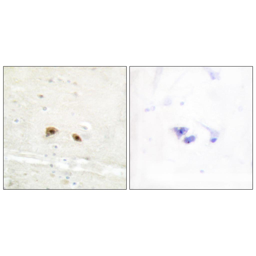 Egr-3 Rabbit Polyclonal Antibody | 兔多抗 | EnkiLife恩玑生命