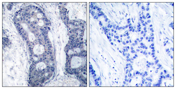 eIF4E Rabbit Polyclonal Antibody | 兔多抗 | EnkiLife恩玑生命
