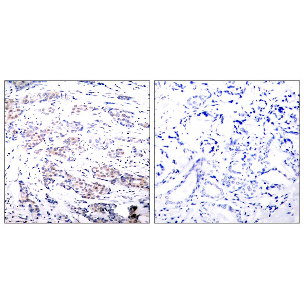 Elk-1 Rabbit Polyclonal Antibody | 兔多抗 | EnkiLife恩玑生命