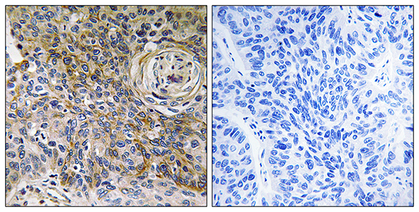 EMMPRIN Rabbit Polyclonal Antibody | 兔多抗 | EnkiLife恩玑生命