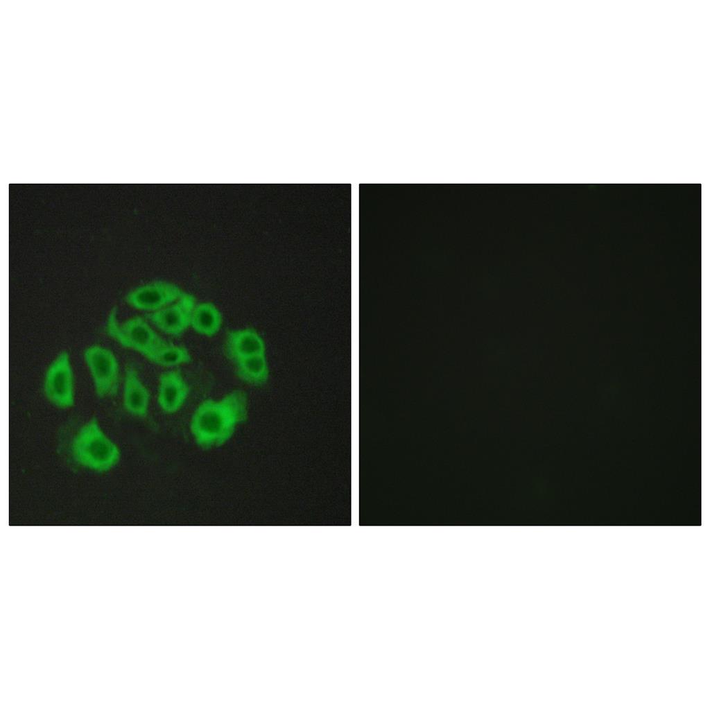 Endomucin Rabbit Polyclonal Antibody | 兔多抗 | EnkiLife恩玑生命