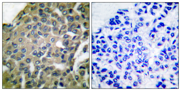 Endoplasmin Rabbit Polyclonal Antibody | 兔多抗 | EnkiLife恩玑生命