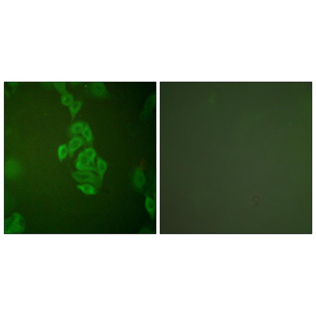Enolase Rabbit Polyclonal Antibody | 兔多抗 | EnkiLife恩玑生命