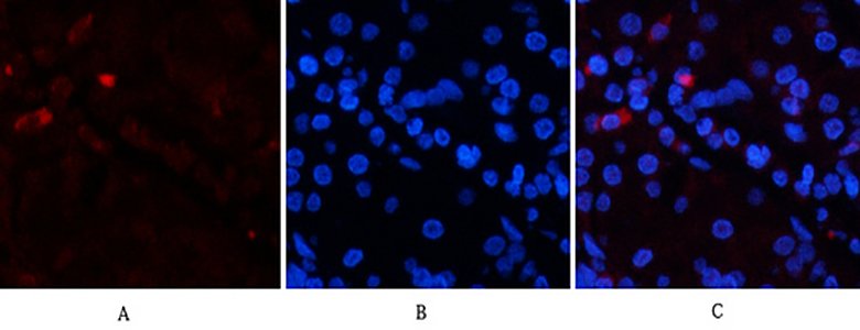 EPAS-1 Rabbit Polyclonal Antibody | 兔多抗 | EnkiLife恩玑生命
