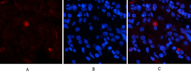 EPAS-1 Rabbit Polyclonal Antibody | 兔多抗 | EnkiLife恩玑生命