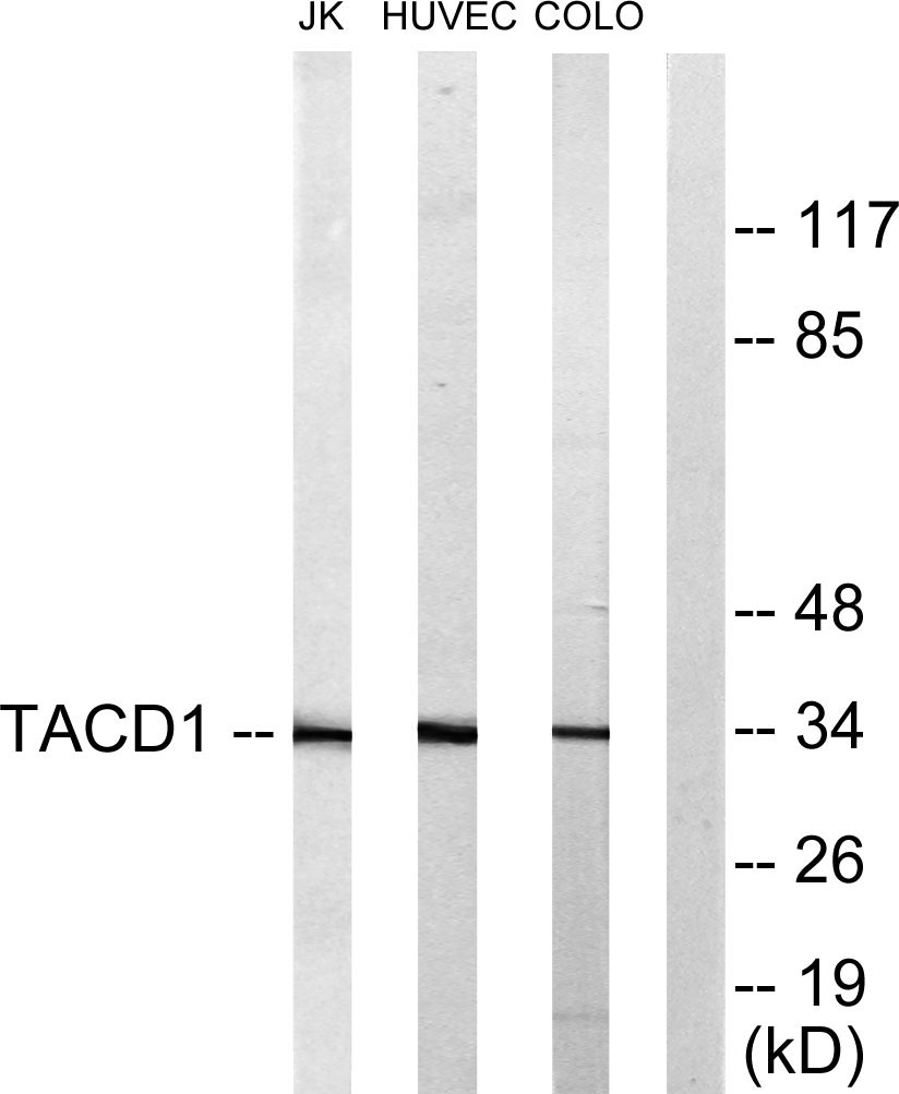 EP-CAM Rabbit Polyclonal Antibody | 兔多抗 | EnkiLife恩玑生命