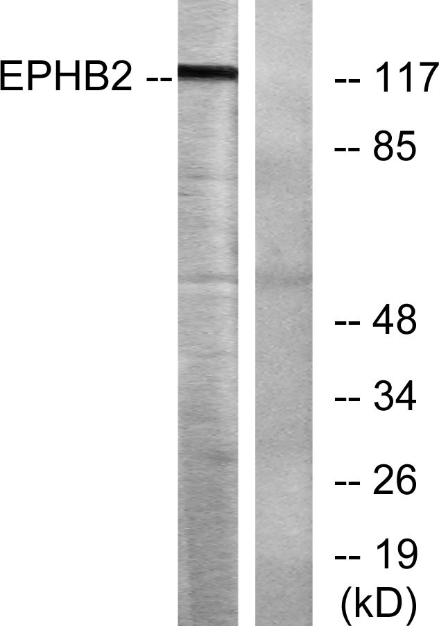 EphB2 Rabbit Polyclonal Antibody | 兔多抗 | EnkiLife恩玑生命