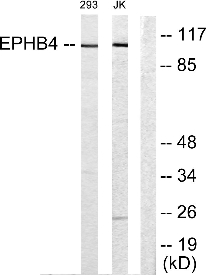 EphB4 Rabbit Polyclonal Antibody | 兔多抗 | EnkiLife恩玑生命