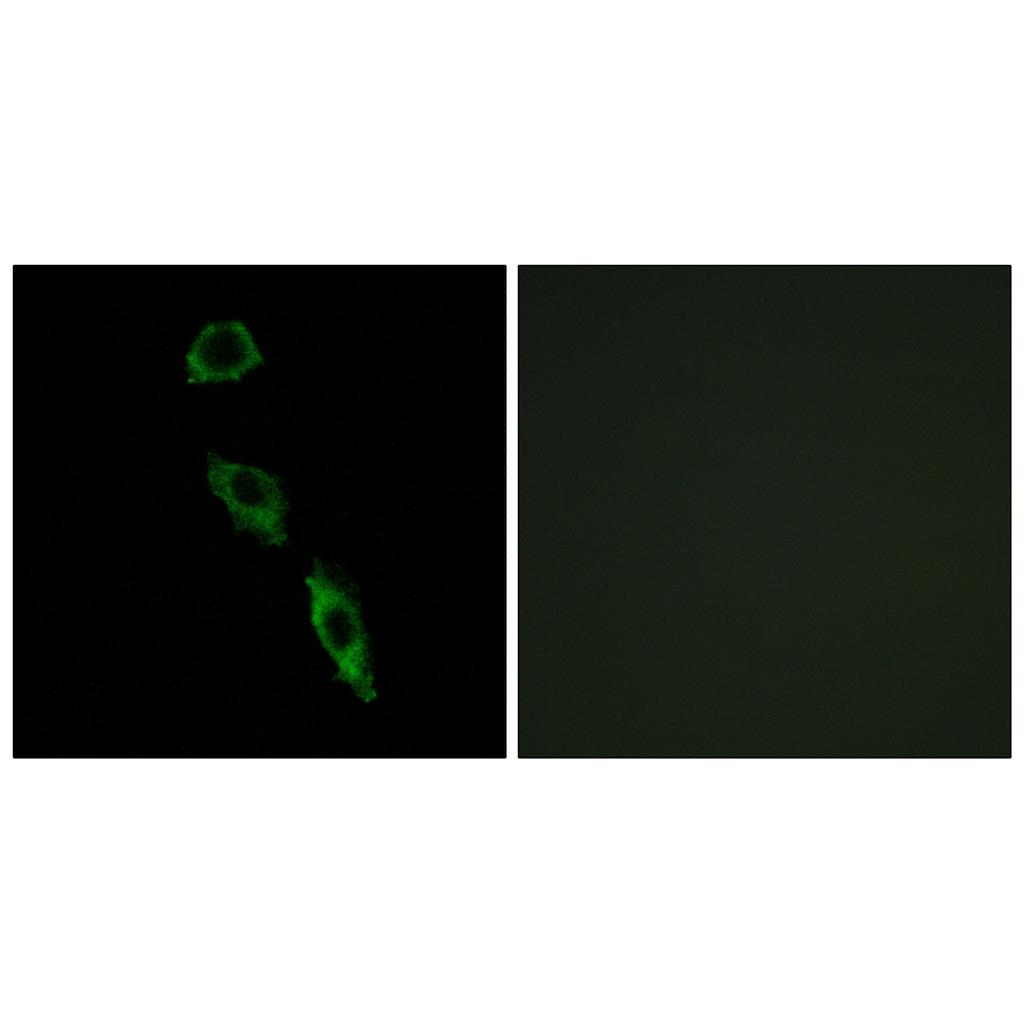 E-Ras Rabbit Polyclonal Antibody | 兔多抗 | EnkiLife恩玑生命