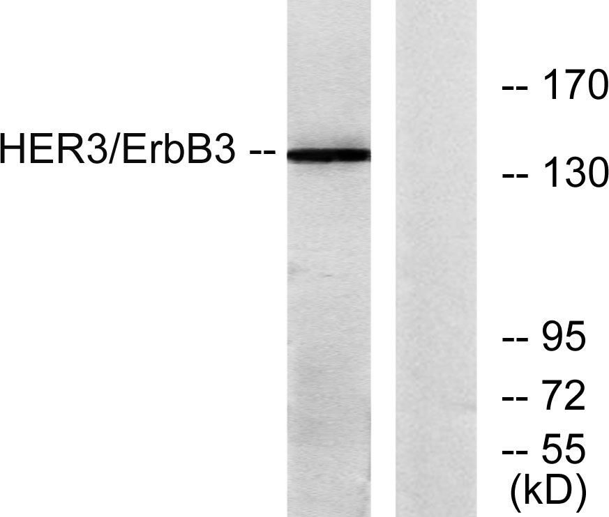 ErbB-3 Rabbit Polyclonal Antibody | 兔多抗 | EnkiLife恩玑生命