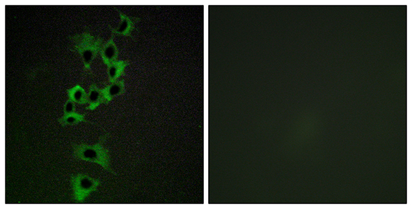 ErbB-4 Rabbit Polyclonal Antibody | 兔多抗 | EnkiLife恩玑生命