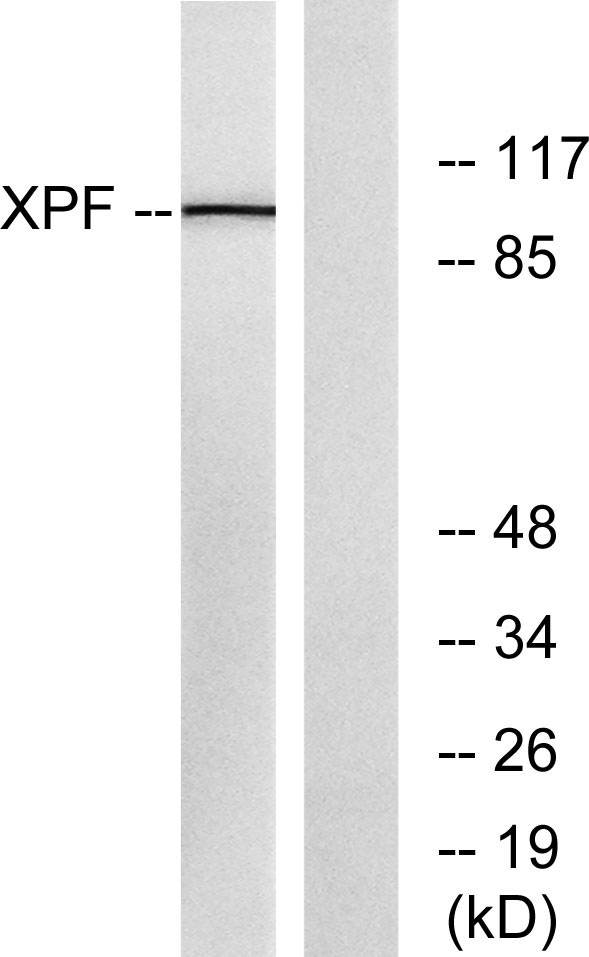 ERCC4 Rabbit Polyclonal Antibody | 兔多抗 | EnkiLife恩玑生命