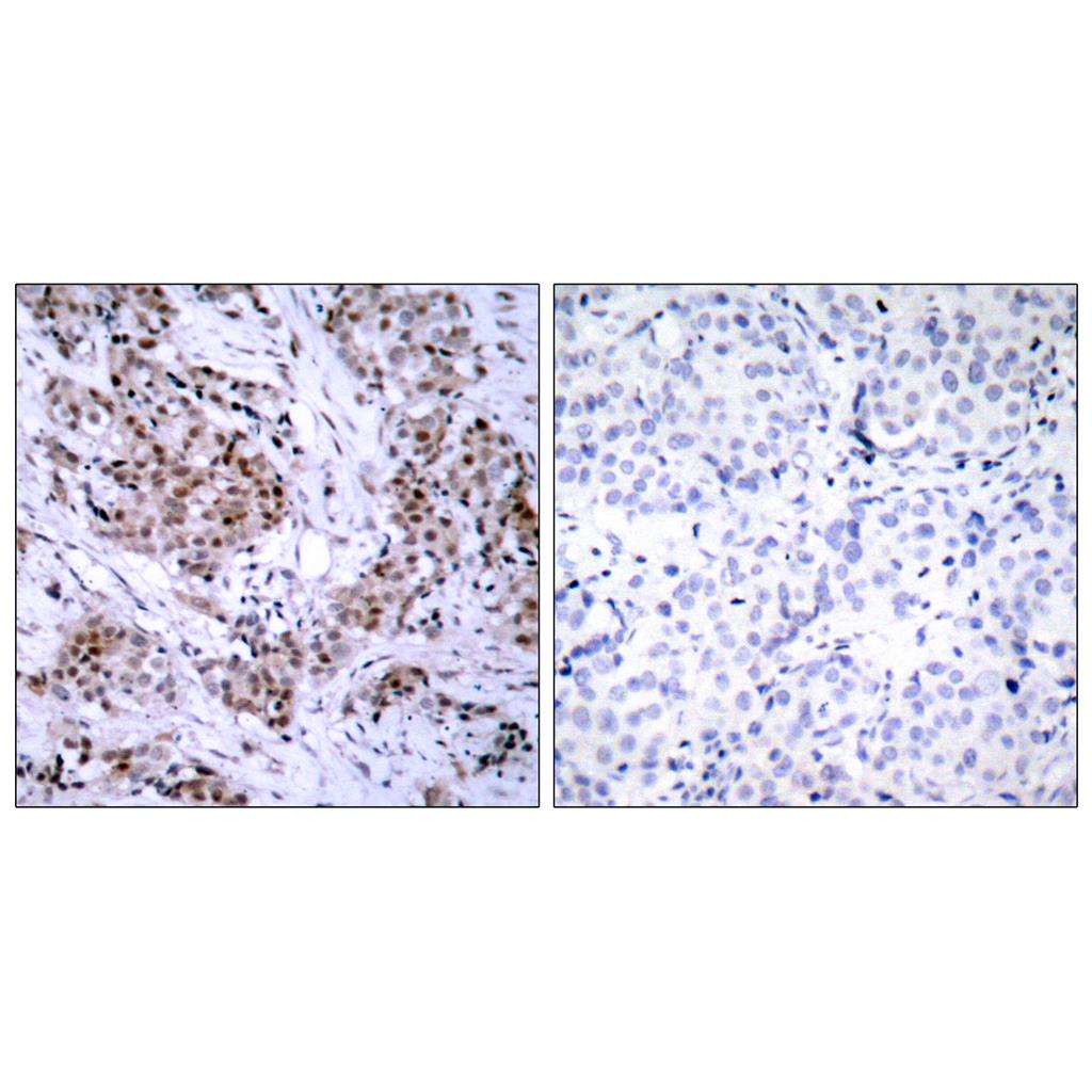 ERα Rabbit Polyclonal Antibody | 兔多抗 | EnkiLife恩玑生命