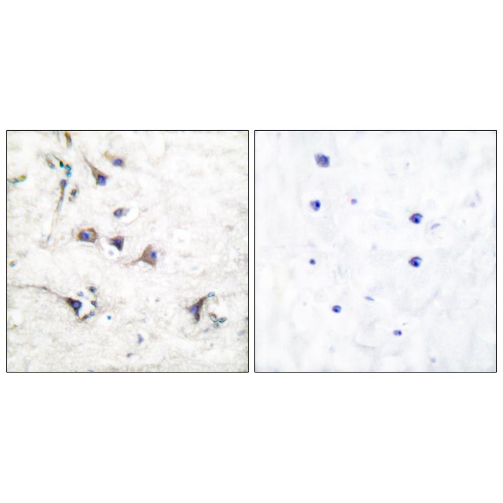 Ezrin Rabbit Polyclonal Antibody | 兔多抗 | EnkiLife恩玑生命
