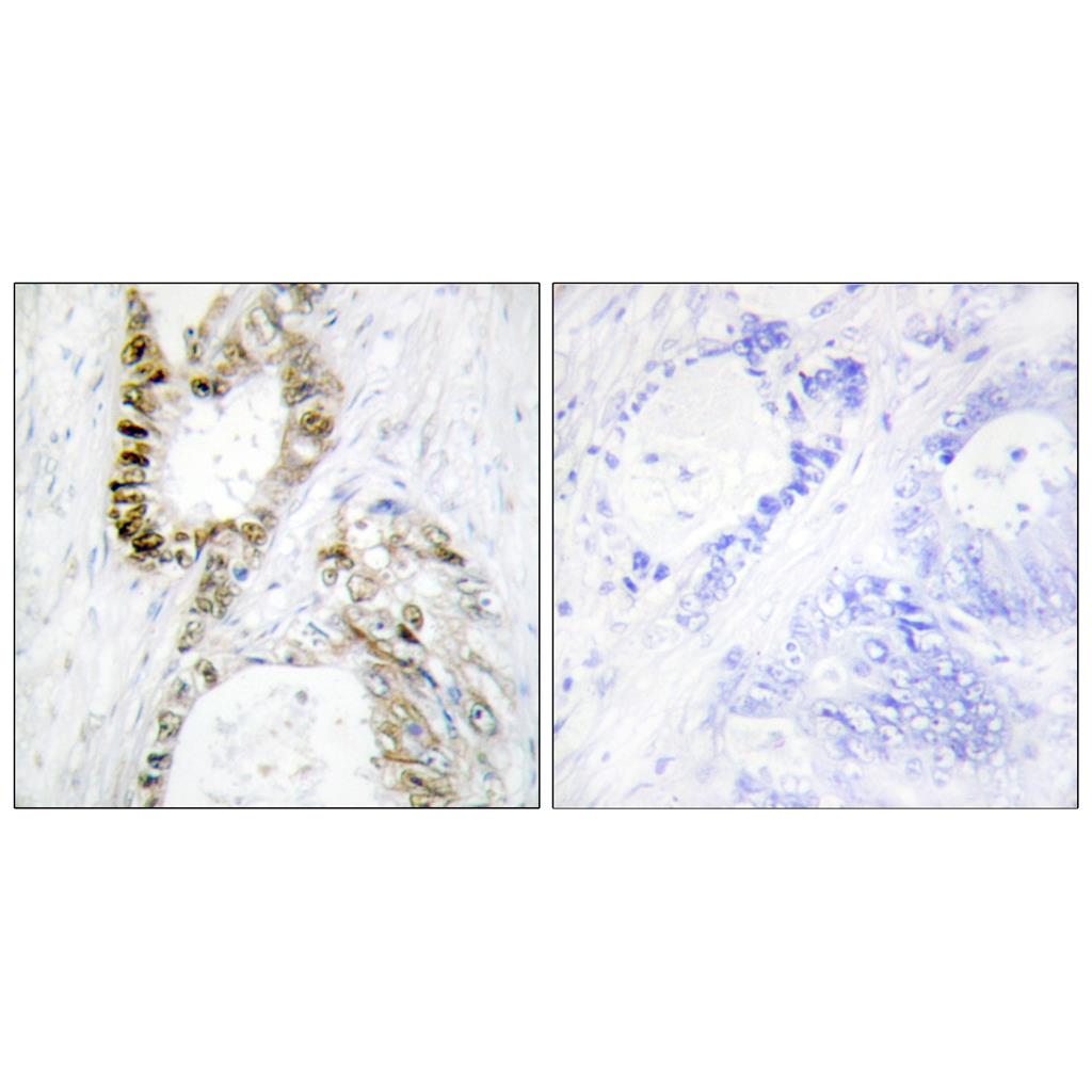 FANCA Rabbit Polyclonal Antibody | 兔多抗 | EnkiLife恩玑生命