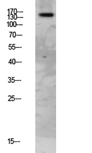 FAP-1 Rabbit Polyclonal Antibody | 兔多抗 | EnkiLife恩玑生命