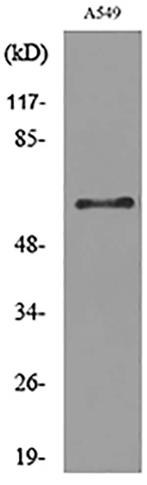 Fascin 1 Rabbit Polyclonal Antibody | 兔多抗 | EnkiLife恩玑生命