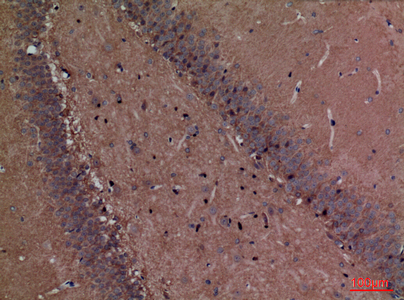 Fascin 1 Rabbit Polyclonal Antibody | 兔多抗 | EnkiLife恩玑生命