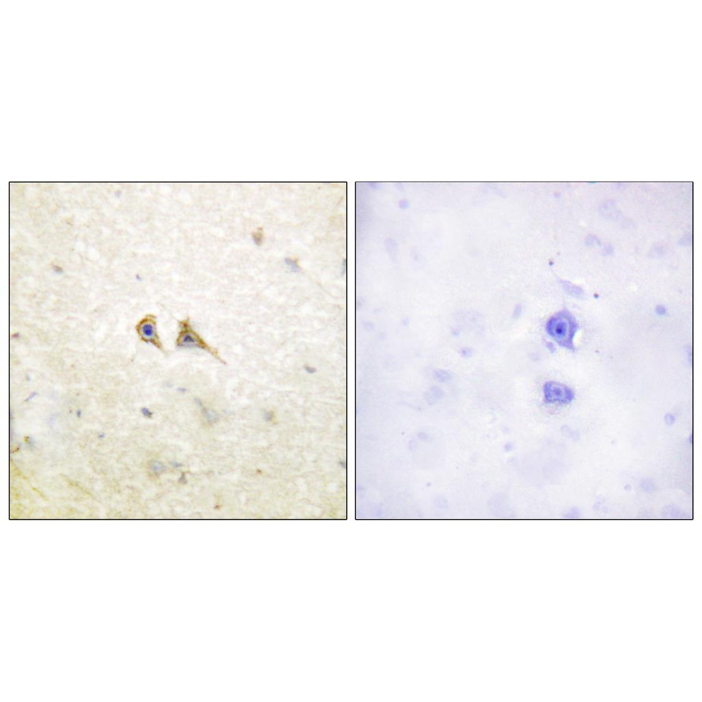 FAS-L Rabbit Polyclonal Antibody | 兔多抗 | EnkiLife恩玑生命