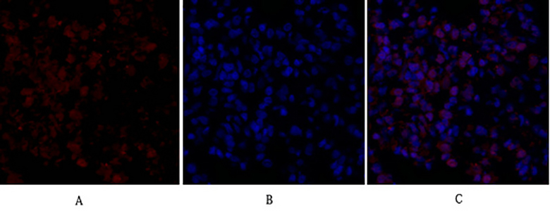FAS-L Rabbit Polyclonal Antibody | 兔多抗 | EnkiLife恩玑生命