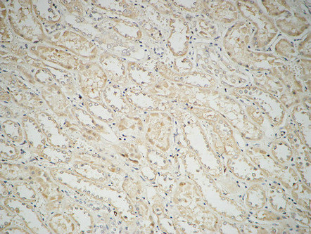 Fatty Acid Synthase Rabbit Polyclonal Antibody | 兔多抗 | EnkiLife恩玑生命
