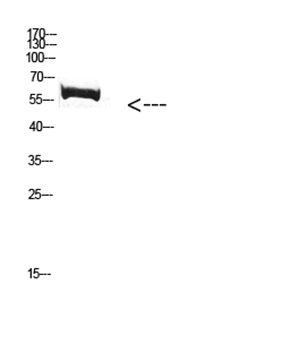 FBXO7 Rabbit Polyclonal Antibody | 兔多抗 | EnkiLife恩玑生命